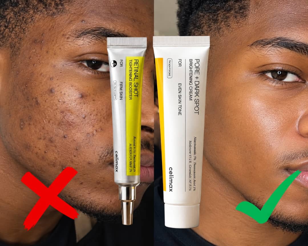 DUO CELIMAX CORÉEN-TACHES, PORES ET TEINTS IRREGULIER